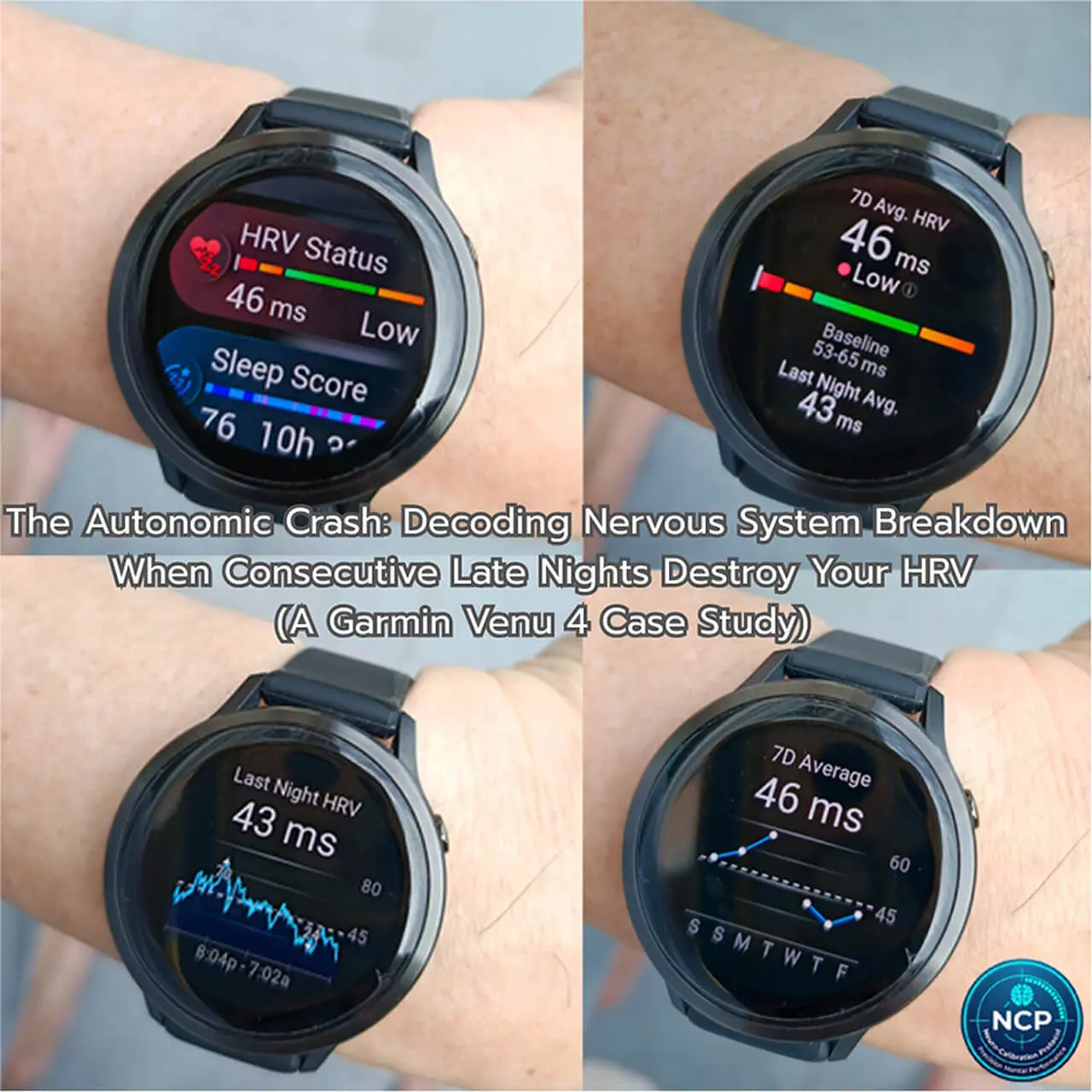 Garmin Venu 4 smartwatch displaying low HRV status and autonomic nervous system crash data